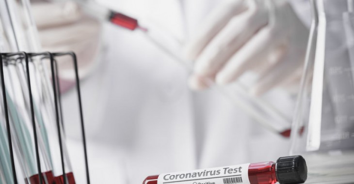Komunikat w sprawie ograniczenia funkcjonowania instytucji lub zakładów pracy w okresie stanu zagrożenia epidemicznego w związku z zakażeniami wirusem SARS-CoV-2 Komunikat w sprawie ograniczenia funkcjonowania instytucji lub zakładów pracy w okresie stanu zagrożenia epidemicznego w związku z zakażeniami wirusem SARS-CoV-2