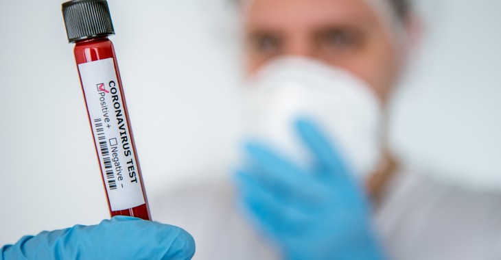 Rozporządzenie w sprawie ustanowienia określonych ograniczeń, nakazów i zakazów w związku z wystąpieniem stanu epidemii - konsultacje robocze Rozporządzenie w sprawie ustanowienia określonych ograniczeń, nakazów i zakazów w związku z wystąpieniem stanu epidemii - konsultacje robocze