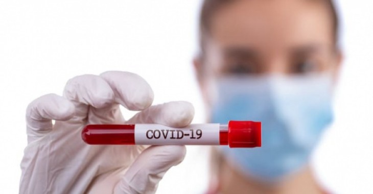 Szybki test na koronawirusa a jakość – dane ze świata Szybki test na koronawirusa a jakość – dane ze świata