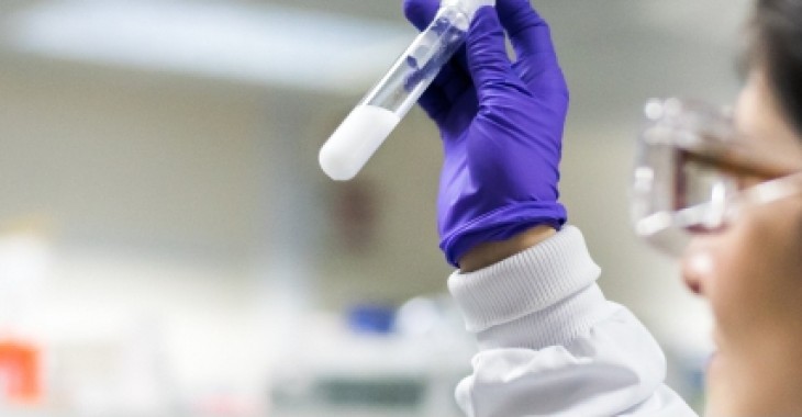 AstraZeneca przekazała 45 000 testów w kierunku SARS-CoV-2 AstraZeneca przekazała 45 000 testów w kierunku SARS-CoV-2