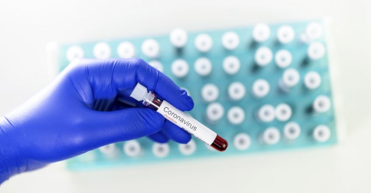 SKUP informuje o pozytywnej ocenie testu antygenowego LumiraDx w kierunku SARS-CoV-2 u pacjentów objawowych i bezobjawowych