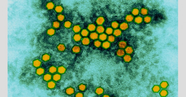 O czy świadczy przypadek polio wykryty w Izraelu? O czy świadczy przypadek polio wykryty w Izraelu?